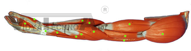 Radial View